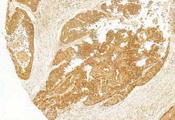 Invitrogen MKS1 Polyclonal Antibody 100 &mu;L; Unconjugated:Antibodies,