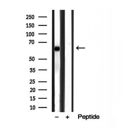 Invitrogen MKS1 Polyclonal Antibody 100 &mu;L; Unconjugated:Antibodies,