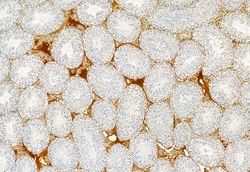 Invitrogen TCTN1 Polyclonal Antibody 100 &mu;L; Unconjugated:Antibodies,