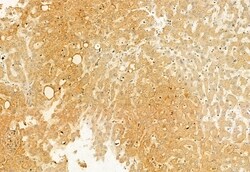Invitrogen TCTN1 Polyclonal Antibody 100 &mu;L; Unconjugated:Antibodies,