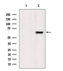 Invitrogen TCTN1 Polyclonal Antibody 100 &mu;L; Unconjugated:Antibodies,