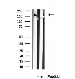 Invitrogen CAMSAP2 Polyclonal Antibody 100 &mu;L; Unconjugated:Antibodies,