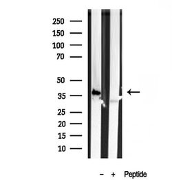 Invitrogen PRKCDBP Polyclonal Antibody 100 &mu;L; Unconjugated:Antibodies,