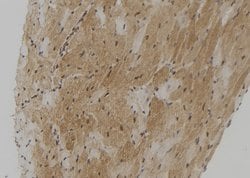 Invitrogen TMPRSS4 Polyclonal Antibody 100 &mu;L; Unconjugated:Antibodies,