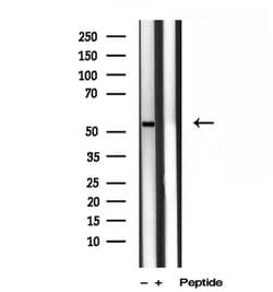 Invitrogen TMPRSS4 Polyclonal Antibody 100 &mu;L; Unconjugated:Antibodies,