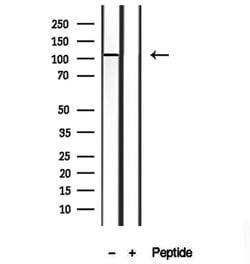 Invitrogen TMEM67 Polyclonal Antibody 100 &mu;L; Unconjugated:Antibodies,