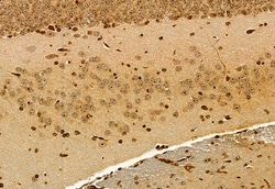 Invitrogen EXOC2 Polyclonal Antibody 100 &mu;L; Unconjugated:Antibodies,