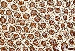 Invitrogen EXOC2 Polyclonal Antibody 100 &mu;L; Unconjugated:Antibodies,