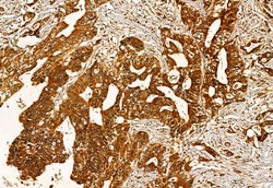 Invitrogen EXOC2 Polyclonal Antibody 100 &mu;L; Unconjugated:Antibodies,
