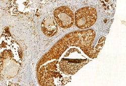 Invitrogen EXOC2 Polyclonal Antibody 100 &mu;L; Unconjugated:Antibodies,