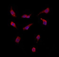 Invitrogen SMCR7 Polyclonal Antibody 100 &mu;L | Buy Online | Invitrogen&trade; | Fisher Scientific