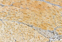 Invitrogen SMCR7 Polyclonal Antibody 100 &mu;L | Buy Online | Invitrogen&trade; | Fisher Scientific