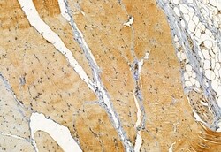 Invitrogen TOM70 Polyclonal Antibody 100 &mu;L; Unconjugated:Antibodies,