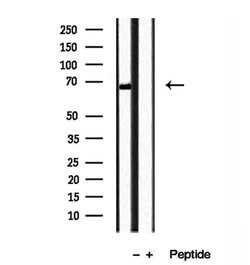 Invitrogen TOM70 Polyclonal Antibody 100 &mu;L; Unconjugated:Antibodies,