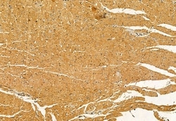 Invitrogen PYCR1 Polyclonal Antibody 100 &mu;L; Unconjugated:Antibodies,