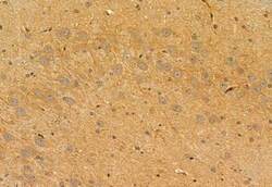 Invitrogen PYCR1 Polyclonal Antibody 100 &mu;L; Unconjugated:Antibodies,