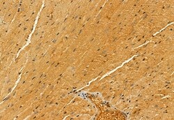 Invitrogen PYCR1 Polyclonal Antibody 100 &mu;L; Unconjugated:Antibodies,