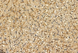 Invitrogen PYCR1 Polyclonal Antibody 100 &mu;L; Unconjugated:Antibodies,