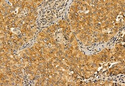 Invitrogen PYCR1 Polyclonal Antibody 100 &mu;L; Unconjugated:Antibodies,