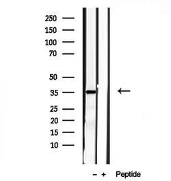 Invitrogen PYCR1 Polyclonal Antibody 100 &mu;L; Unconjugated:Antibodies,