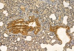 Invitrogen MPP5 Polyclonal Antibody 100 &mu;L; Unconjugated:Antibodies,