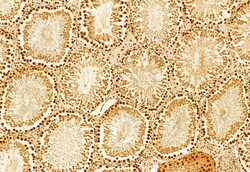 Invitrogen ODF2 Polyclonal Antibody 100 &mu;L; Unconjugated:Antibodies,