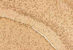 Invitrogen RBM15 Polyclonal Antibody 100 &mu;L; Unconjugated:Antibodies,