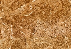 Invitrogen RBM15 Polyclonal Antibody 100 &mu;L; Unconjugated:Antibodies,