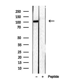 Invitrogen RBM15 Polyclonal Antibody 100 &mu;L; Unconjugated:Antibodies,