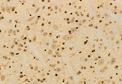 Invitrogen UBAP1 Polyclonal Antibody 100 &mu;L | Buy Online | Invitrogen&trade; | Fisher Scientific