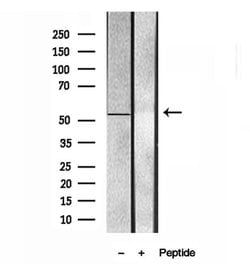 Invitrogen UBAP1 Polyclonal Antibody 100 &mu;L | Buy Online | Invitrogen&trade; | Fisher Scientific