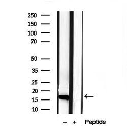 Invitrogen CHCHD2 Polyclonal Antibody 100 &mu;L; Unconjugated:Antibodies,