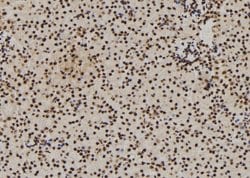Invitrogen DDX21 Polyclonal Antibody 100 &mu;L; Unconjugated:Antibodies,