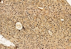 Invitrogen DDX21 Polyclonal Antibody 100 &mu;L; Unconjugated:Antibodies,