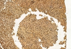 Invitrogen DDX21 Polyclonal Antibody 100 &mu;L; Unconjugated:Antibodies,