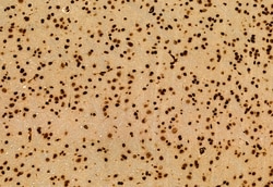 Invitrogen DDX21 Polyclonal Antibody 100 &mu;L; Unconjugated:Antibodies,