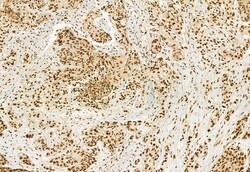 Invitrogen DDX21 Polyclonal Antibody 100 &mu;L; Unconjugated:Antibodies,