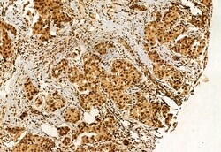 Invitrogen DDX21 Polyclonal Antibody 100 &mu;L; Unconjugated:Antibodies,