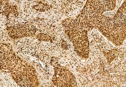 Invitrogen DDX21 Polyclonal Antibody 100 &mu;L; Unconjugated:Antibodies,