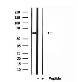 Invitrogen HEPACAM Polyclonal Antibody 100 &mu;L; Unconjugated:Antibodies,