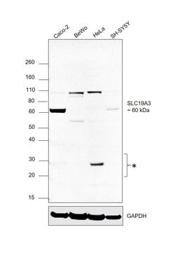 Invitrogen SLC19A3 Polyclonal Antibody 100 &mu;L; Unconjugated:Antibodies,