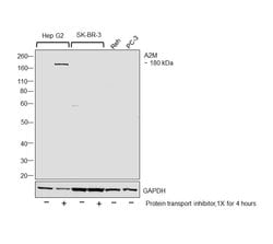 Invitrogen A2M Polyclonal Antibody 100 &mu;L | Buy Online | Invitrogen&trade; | Fisher Scientific