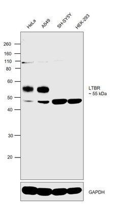 Invitrogen LTBR Polyclonal Antibody 100 &mu;L | Buy Online | Invitrogen&trade; | Fisher Scientific
