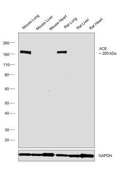 Invitrogen ACE Polyclonal Antibody 100 &mu;L; Unconjugated:Antibodies,