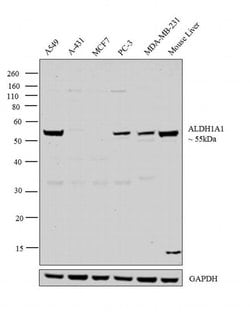 Invitrogen ALDH1A1 Polyclonal Antibody 400 &mu;L; Unconjugated:Antibodies,