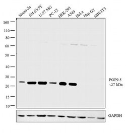 Invitrogen PGP9.5 Polyclonal Antibody 400 &mu;L; Unconjugated:Anticuerpos
