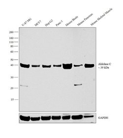 Invitrogen Aldolase C Polyclonal Antibody 400 &mu;L | Buy Online | Invitrogen&trade; | Fisher Scientific