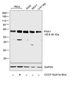 Invitrogen PINK1 Polyclonal Antibody 400 &mu;L; Unconjugated:Antibodies,