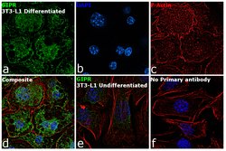 Invitrogen GIPR Polyclonal Antibody 400 &mu;L; Unconjugated:Antibodies,
