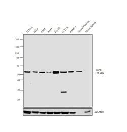 Invitrogen GIPR Polyclonal Antibody 400 &mu;L; Unconjugated:Antibodies,